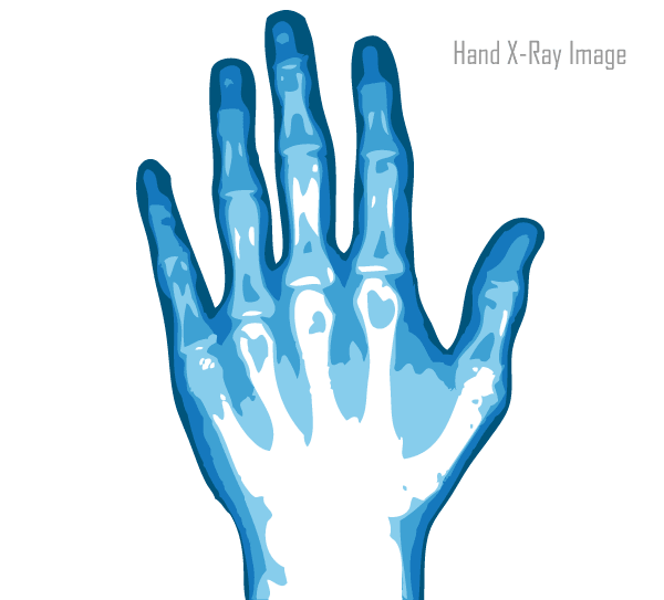 X-Ray Hand Vector Image